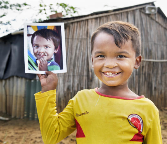 Il piccolo Pedro è uno dei pazienti curati grazie ai programmi medici di Operation Smile. Dal Venezuela è arrivato con la sua famiglia in Colombia, dove ha ritrovato la speranza in un futuro migliore. A Riohacha, grazie a un programma chirurgico di Operation Smile, ha ritrovato il suo nuovo sorriso.